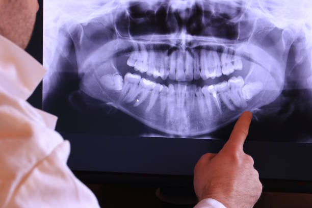 Best Emergency Tooth Extraction in Premont, TX